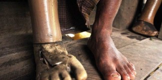 Nepal: Landmine victims need more help
